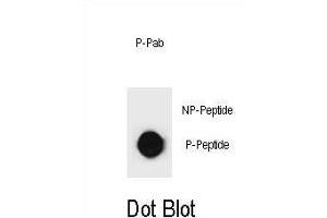 Dot blot analysis of KIT Antibody (Phospho ) Phospho-specific Pab (ABIN1881481 and ABIN2850471) on nitrocellulose membrane. (KIT Antikörper  (pSer891))