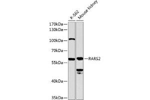 Western blot analysis of extracts of various cell lines, using R antibody (ABIN6129727, ABIN6146710, ABIN6146711 and ABIN6224588) at 1:1000 dilution. (RARS2 Antikörper  (AA 17-340))