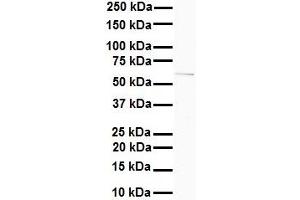 WB Suggested Anti-SLC7A1 antibody Titration: 1 ug/mL Sample Type: Human MDA-MB-435s (SLC7A1 Antikörper  (N-Term))