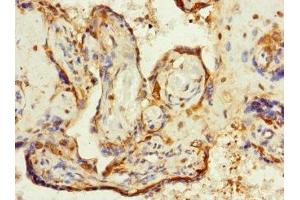 Immunohistochemistry of paraffin-embedded human placenta tissue using ABIN7176726 at dilution of 1:100 (ZP2 Antikörper  (AA 651-745))