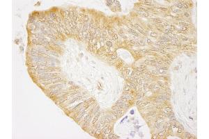 anti-C-Abl Oncogene 1, Non-Receptor tyrosine Kinase (ABL1) (AA 850-900) antibody