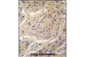 Immunohistochemistry (Paraffin-embedded Sections) (IHC (p)) image for anti-Caspase 3 (CASP3) (AA 60-90) antibody (ABIN391813)