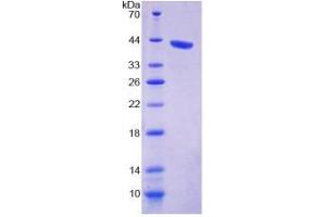 SDS-PAGE (SDS) image for WW and C2 Domain Containing 1 (WWC1) (AA 847-1094) protein (His tag) (ABIN4990959)