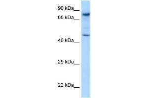 WB Suggested Anti-Skil Antibody Titration: 1. (SKIL Antikörper  (C-Term))