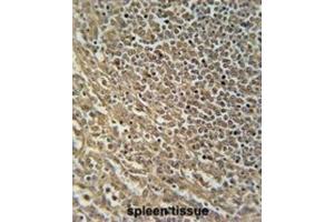 Immunohistochemistry (IHC) image for anti-RAS Protein Activator Like 3 (RASAL3) antibody (ABIN5015361) (RASAL3 Antikörper)