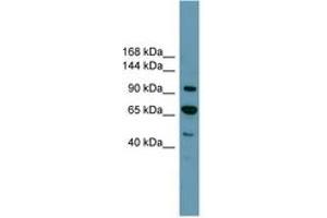 Image no. 1 for anti-Retinoblastoma Protein (Rb Protein) (C-Term) antibody (ABIN6744235) (Retinoblastoma Protein (Rb) Antikörper  (C-Term))