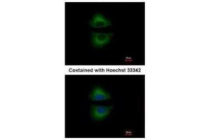 ICC/IF Image Immunofluorescence analysis of methanol-fixed A549, using GRAP, antibody at 1:500 dilution. (GRAP Antikörper  (C-Term))