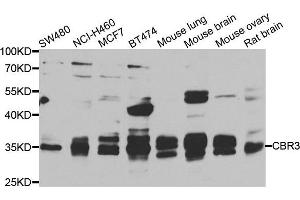 Western blot analysis of extracts of various cell lines, using CBR3 antibody.