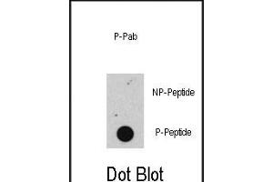 Dot blot analysis of anti-Phospho-RB- Antibody (ABIN389642 and ABIN2839634) on nitrocellulose membrane.