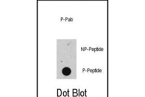 Dot blot analysis of anti-Phospho-RB- Antibody (ABIN389642 and ABIN2839634) on nitrocellulose membrane. (Retinoblastoma 1 Antikörper  (pSer608))