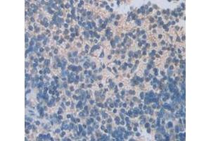 Immunohistochemistry (IHC) image for anti-Insulin-Like Growth Factor Binding Protein 2, 36kDa (IGFBP2) (AA 24-305) antibody (ABIN1172088)