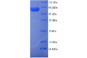 SDS-PAGE (SDS) image for Tripartite Motif Containing 21 (TRIM21) (AA 1-475), (full length) protein (His tag) (ABIN5713912) (TRIM21 Protein (AA 1-475, full length) (His tag))