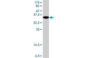 Western Blot detection against Immunogen (37. (CBS Antikörper  (AA 1-100))