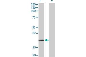 Western Blot analysis of NAT2 expression in transfected 293T cell line by NAT2 monoclonal antibody (M01), clone 3B5. (NAT2 Antikörper  (AA 96-195))