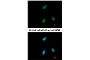 ICC/IF Image Immunofluorescence analysis of paraformaldehyde-fixed A549, using CLUAP1, antibody at 1:500 dilution. (CLUAP1 Antikörper)
