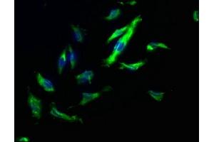 Immunofluorescence staining of U251 cells with ABIN7140173 at 1:200, counter-stained with DAPI. (TJP2 Antikörper  (AA 1165-1183))