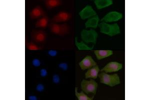 ABIN6256251 and ABIN6267221 staining Hela cells by IF/ICC. (CHEK1 Antikörper  (pSer296))