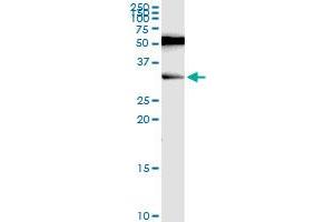 RAG2 monoclonal antibody (M06), clone 2G8. (RAG2 Antikörper  (AA 428-527))