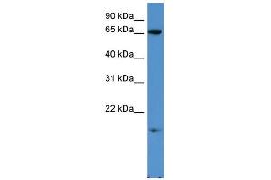 WB Suggested Anti-RHOXF1 Antibody Titration: 0. (RHOXF1 Antikörper  (C-Term))