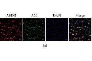 ABIN1 is colocated with A20 and NeuN and Iba-1, respectively, in the peri-infarct cortex. (TNIP1 Antikörper)