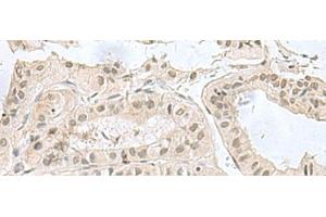 Immunohistochemistry (Paraffin-embedded Sections) (IHC (p)) image for anti-Pterin-4 alpha-Carbinolamine Dehydratase/dimerization Cofactor of Hepatocyte Nuclear Factor 1 alpha (PCBD1) antibody (ABIN7247360)