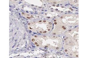 ABIN6267387 at 1/200 staining human kidney tissue sections by IHC-P. (ATF2 Antikörper  (pSer44, pSer62))