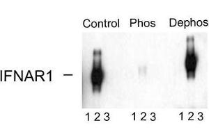Image no. 1 for anti-Interferon alpha/beta Receptor 1 (IFNAR1) (pSer535), (pSer539) antibody (ABIN372660) (IFNAR1 Antikörper  (pSer535, pSer539))