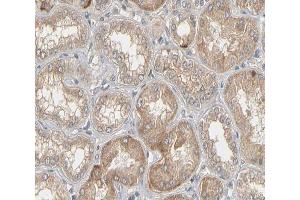 ABIN6266517 at 1/200 staining human kidney tissue sections by IHC-P. (Connexin 43/GJA1 Antikörper  (Internal Region))