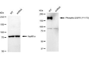 Western blotting analysis using Phospho-EGFR (Y) antibody (ABIN7798469). (Rekombinanter EGFR Antikörper  (pTyr1173))
