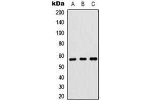 Western blot analysis of p57 Kip2 expression in HeLa (A), SHSY5Y (B), rat brain (C) whole cell lysates. (CDKN1C Antikörper  (N-Term))