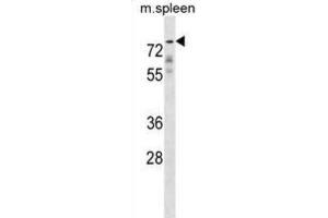 Western Blotting (WB) image for anti-Glypican 2 (GPC2) antibody (ABIN2998770) (GPC2 Antikörper)