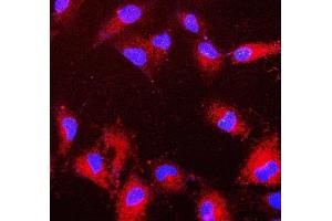 IF analysis of PRDX6 using anti-PRDX6 antibody (ABIN7600102).