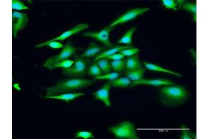 Immunofluorescence of purified MaxPab antibody to GUCA1C on HeLa cell. (GUCA1C Antikörper  (AA 1-209))