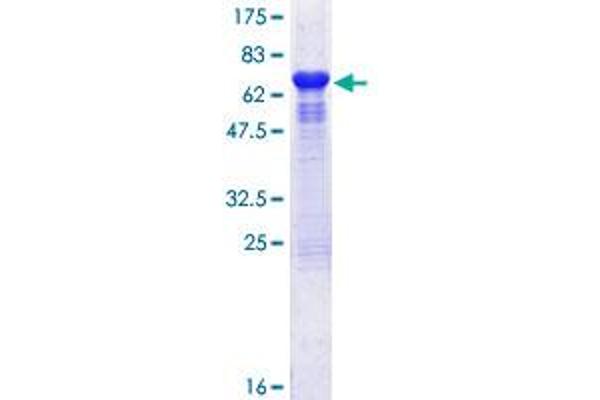 HSC70 Interacting Protein HIP Protein (AA 1-369) (GST tag)