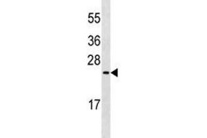 Western Blotting (WB) image for anti-Mucin 1 (MUC1) (N-Term) antibody (ABIN3031867)