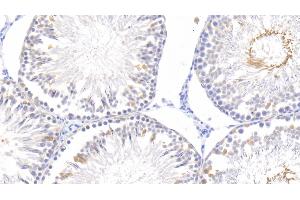 Detection of EGF in Rat Testis Tissue using Monoclonal Antibody to Epidermal Growth Factor (EGF)