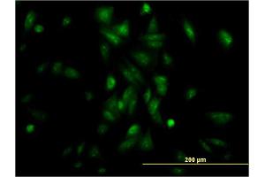 Immunofluorescence of monoclonal antibody to NR1H4 on HepG2 cell. (NR1H4 Antikörper  (AA 363-472))
