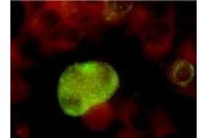 Immunofluorescence (IF) image for anti-Herpes Simplex Virus Type 2, Glycoprotein G (HSV2 gG) antibody (ABIN265564)