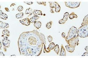 IHC analysis of MID1 using anti-MID1 antibody (ABIN6719400). (MID1 Antikörper  (AA 226-278))