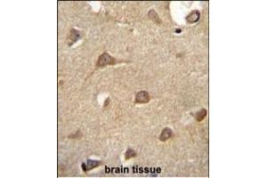 ENTPD3 antibody (C-term) (ABIN654673 and ABIN2844368) immunohistochemistry analysis in formalin fixed and paraffin embedded human brain tissue followed by peroxidase conjugation of the secondary antibody and DAB staining. (ENTPD3 Antikörper  (C-Term))