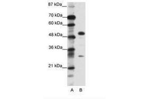 Image no. 1 for anti-Glial Cells Missing Homolog 1 (GCM1) (C-Term) antibody (ABIN6736096) (GCM1 Antikörper  (C-Term))