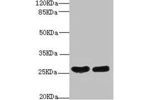 Western blot All lanes: CRP antibody at 2 μg/mL Lane 1: High values of serum at 1: 5 Lane 2: High values of serum at 1: 10 Secondary Goat polyclonal to rabbit IgG at 1/10000 dilution Predicted band size: 26, 11 kDa Observed band size: 26 kDa (CRP Antikörper  (AA 19-224))