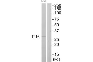 Western Blotting (WB) image for anti-Interferon, alpha-Inducible Protein 6 (IFI6) (C-Term) antibody (ABIN1852572) (IFI6 Antikörper  (C-Term))