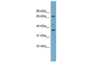 WB Suggested Anti-C1orf166 Antibody Titration:  0.