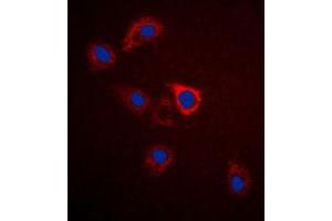 Immunofluorescent analysis of GPR75 staining in A549 cells. (GPR75 Antikörper  (C-Term))