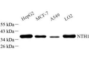 Western blot analysis of NTHL1 (ABIN7074866) at dilution of 1: 1000 (Nth Endonuclease III-Like 1 (NTHL1) Antikörper)