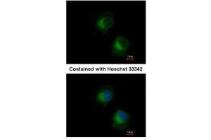 ICC/IF Image Immunofluorescence analysis of methanol-fixed HeLa, using IFIT3, antibody at 1:500 dilution. (IFIT3 Antikörper)