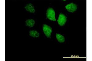 Immunofluorescence of purified MaxPab antibody to BRF1 on HeLa cell. (BRF1 Antikörper  (AA 1-473))