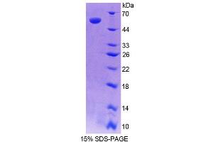 SDS-PAGE analysis of Human RARRES1 Protein. (RARRES1 Protein)