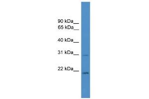 WB Suggested Anti-HOXB1 Antibody Titration:  0. (HOXB1 Antikörper  (C-Term))